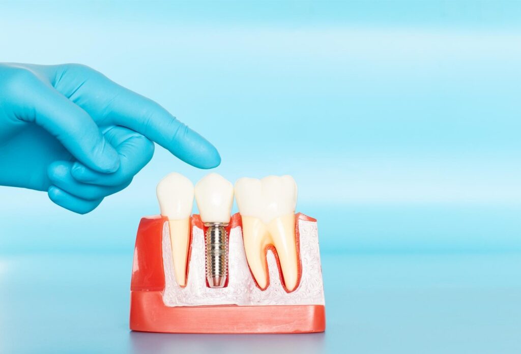 dentist in hb town pardi