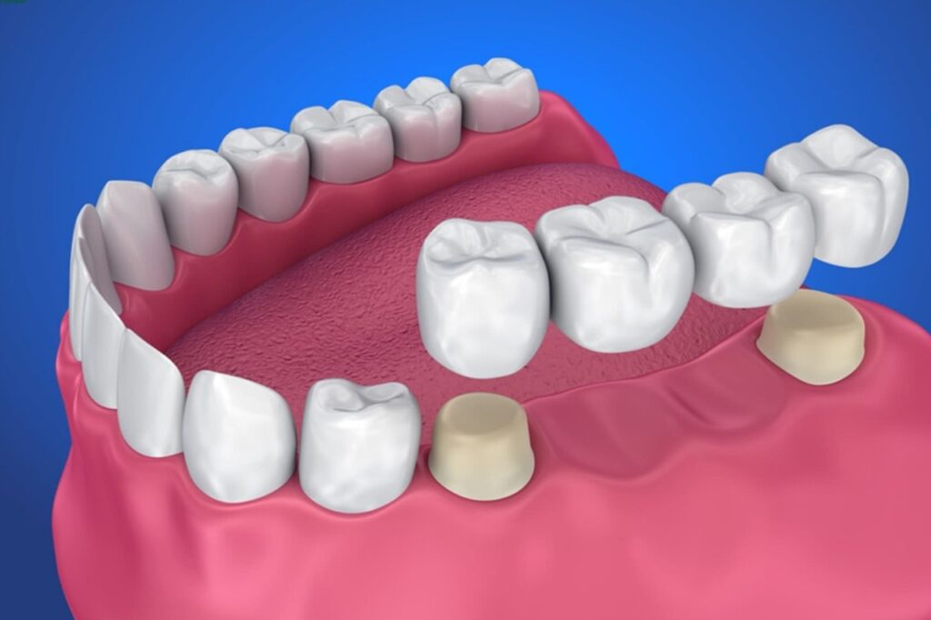 dentist in hb town pardi